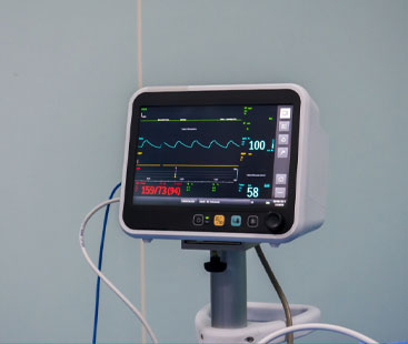 Electrocardiogram (ECG)