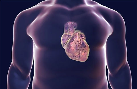 Valvular Heart Disease